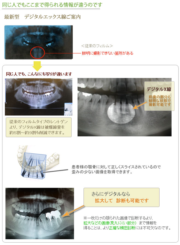 最新の歯科用CT